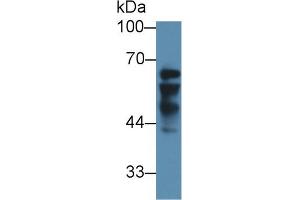 Western blot analysis of Human Liver lysate, using Human IGF2BP2 Antibody (3 µg/ml) and HRP-conjugated Goat Anti-Rabbit antibody ( (IGF2BP2 抗体  (AA 141-384))