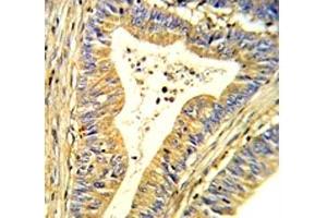 Immunohistochemistry (IHC) image for anti-Superoxide Dismutase 1, Soluble (SOD1) (AA 55-84) antibody (ABIN3032771)