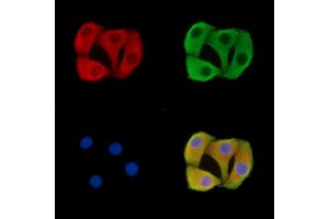 ABIN7095772 and ABIN7099834 staining Hela cells by IF/ICC. (Slc38a5 抗体)