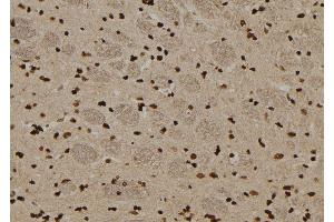 ABIN6276548 at 1/100 staining Rat brain tissue by IHC-P. (TRADD 抗体  (N-Term))