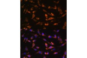 Immunofluorescence analysis of L929 cells using CSF2 antibody (ABIN6130426, ABIN6139094, ABIN6139095 and ABIN6221725) at dilution of 1:100. (GM-CSF 抗体  (AA 18-144))