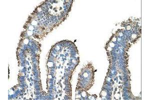 Image no. 1 for anti-Matrix Metallopeptidase 1 (Interstitial Collagenase) (MMP1) (AA 21-70) antibody (ABIN203491) (MMP1 抗体  (AA 21-70))