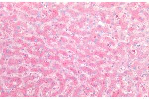 Immunohistochemistry of paraffin-embedded Human liver tissue using ORM2 Polyclonal Antibody at dilution of 1:100. (Orosomucoid 2 抗体)