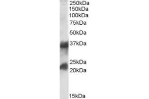 Image no. 1 for anti-Clathrin, Light Chain A (CLTA) (Internal Region), (Light Chain) antibody (ABIN375031) (CLTA 抗体  (Internal Region, Light Chain))