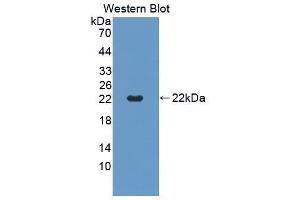 Western blot analysis of the recombinant protein. (CD40 抗体  (AA 26-193))