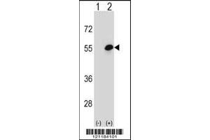 Western blot analysis of COCH using rabbit polyclonal COCH Antibody using 293 cell lysates (2 ug/lane) either nontransfected (Lane 1) or transiently transfected (Lane 2) with the COCH gene. (COCH 抗体  (AA 399-428))