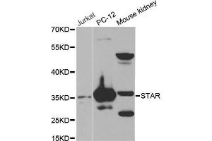 Western blot analysis of extracts of various cell lines, using STAR antibody. (STAR 抗体  (AA 64-285))