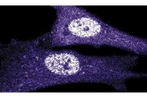 Immunoflourescence staining of human fibroblasts.