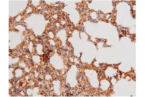 Immunohistochemistry (IHC) image for anti-Forkhead Box O4 (FOXO4) (pSer197) antibody (ABIN6255069)