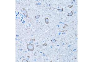 Immunohistochemistry of paraffin-embedded mouse spinal cord using NNMT antibody (ABIN5974021) at dilution of 1/100 (40x lens). (NNMT 抗体)