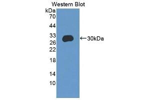 Detection of Recombinant CEBPd, Mouse using Polyclonal Antibody to CCAAT/Enhancer Binding Protein Delta (CEBPd) (CEBPD 抗体  (AA 51-251))