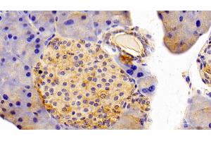 Immunohistochemistry (IHC) image for anti-Sepiapterin Reductase (SPR) (AA 1-261) antibody (ABIN7441451)