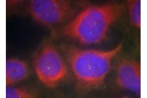 Image no. 1 for anti-NMDA Receptor 1 (NMDA R1) (AA 895-899) antibody (ABIN401632) (NMDA 1 Receptor 抗体  (AA 895-899))