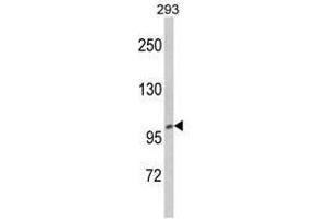 Image no. 1 for anti-CTD (Carboxy-terminal Domain, RNA Polymerase II, Polypeptide A) Phosphatase, Subunit 1 (CTDP1) (N-Term) antibody (ABIN452884)