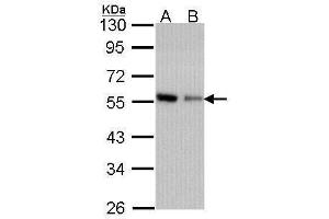 WB Image Sample (30 ug of whole cell lysate) A: A431 , B: H1299 10% SDS PAGE antibody diluted at 1:1000 (CORO1C 抗体  (C-Term))