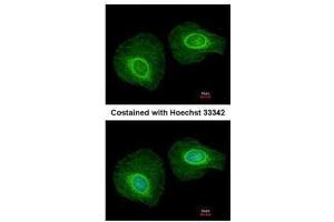 ICC/IF Image Immunofluorescence analysis of methanol-fixed HeLa, using Cytokeratin 34, antibody at 1:200 dilution. (Keratin 34 抗体)