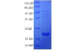 SDS-PAGE (SDS) image for Ephrin A1 (EFNA1) (AA 18-182), (full length) protein (His tag) (ABIN7479017)