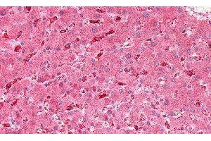 Detection of GBA in Human Liver Tissue using Polyclonal Antibody to Glucocerebrosidase (GBA) (GBA 抗体  (AA 334-498))