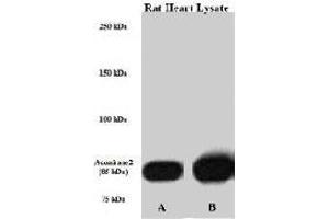 Perfused isolated rat heart whole tissue lysate was lysed with either A) 50 mM Tris-HCl, 150 mM NaCl, 1 mM EDTA, 1% NP-40, 0.