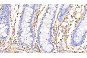 Detection of HbA1c in Human Colon Tissue using Polyclonal Antibody to Glycated Hemoglobin A1c (HbA1c)