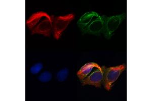 ABIN6262625 and ABIN6268687 staining Hela by IF/ICC. (IL2 Receptor beta 抗体  (N-Term))