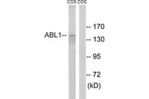 Western blot analysis of extracts from COS7 cells, treated with calyculinA 50ng/ml 30', using ABL1 (Ab-735) Antibody. (ABL1 抗体  (AA 701-750))