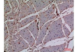 Immunohistochemistry (IHC) image for anti-Cyclin-Dependent Kinase 4 (CDK4) (N-Term) antibody (ABIN3187734)