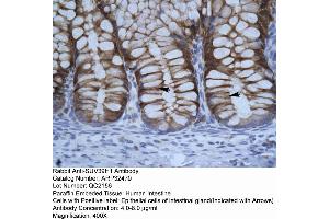 Human Intestine (SUV39H1 抗体  (C-Term))