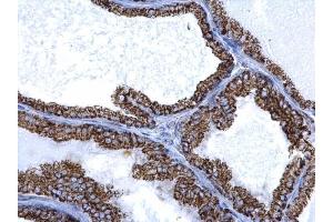 Immunohistochemistry (IHC) image for anti-Aldehyde Dehydrogenase 2 Family (Mitochondrial) (ALDH2) (Center) antibody (ABIN2855041)