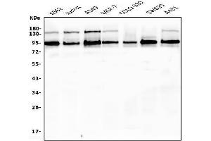 Western blot analysis of EWSR1 using anti-EWSR1 antibody (ABIN6719313).