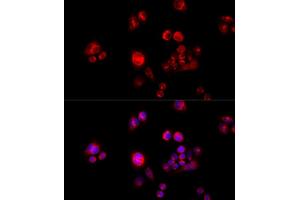 Immunofluorescence analysis of HeLa cells using GLUD2 antibody (ABIN2562844) at dilution of 1:100 (40x lens). (GLUD2 抗体)