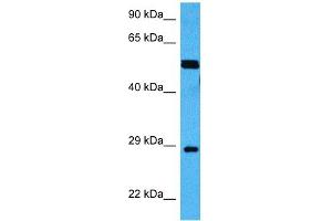 Host:  Mouse  Target Name:  MECP2  Sample Tissue:  Mouse Skeletal Muscle  Antibody Dilution:  1ug/ml (MECP2 抗体  (Middle Region))