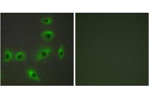 Immunofluorescence analysis of HUVEC cells, using BAX antibody. (BAX 抗体  (Internal Region))