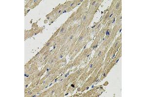 Immunohistochemistry of paraffin-embedded rat heart using SMN2 antibody. (SMN2 抗体  (AA 1-197))