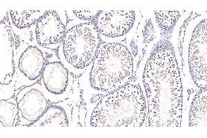 Detection of FXR in Rat Testis Tissue using Polyclonal Antibody to Farnesoid X Receptor (FXR)