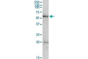 PDE9A MaxPab rabbit polyclonal antibody. (PDE9A 抗体  (AA 1-533))