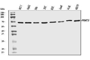 Western blot analysis of PRMT3 using anti-PRMT3 antibody (ABIN7599822).