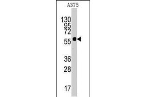 Western blot analysis of KREMEN1 polyclonal antibody  in A-375 cell line lysates (35 ug/lane). (KREMEN1 抗体  (N-Term))