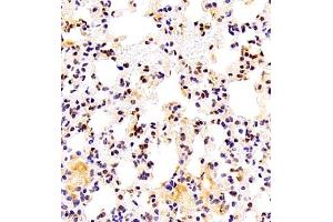 Immunohistochemistry (Paraffin-embedded Sections) (IHC (p)) image for anti-General Transcription Factor IIIC, Polypeptide 2, beta 110kDa (GTF3C2) antibody (ABIN7074038)