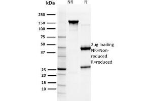 SDS-PAGE Analysis Purified GST Mu3 Mouse Monoclonal Antibody (CPTC- GSTMu3-1). (GSTM3 抗体)