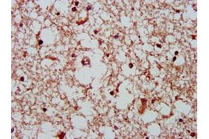 IHC image of ABIN7154521 diluted at 1:400 and staining in paraffin-embedded human brain tissue performed on a Leica BondTM system. (GHITM 抗体  (AA 293-345))