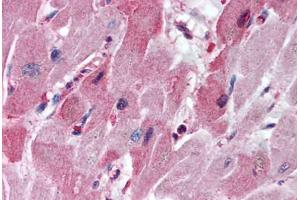 Human Heart (formalin-fixed, paraffin-embedded) stained with HTR3A antibody ABIN297638 at 5 ug/ml followed by biotinylated goat anti-rabbit IgG secondary antibody ABIN481713, alkaline phosphatase-streptavidin and chromogen. (Serotonin Receptor 3A 抗体  (AA 21-36))