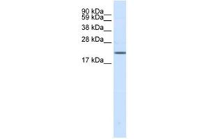 Western Blotting (WB) image for anti-Sodium Channel, Voltage-Gated, Type III, beta Subunit (SCN3B) (N-Term) antibody (ABIN633798)