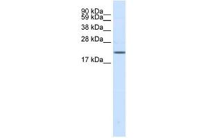 Western Blot showing SCN3B antibody used at a concentration of 1-2 ug/ml to detect its target protein. (SCN3B 抗体  (N-Term))
