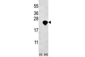 Western blot analysis of Bid antibody and 293 cell lysate (2 ug/lane) either nontransfected (Lane 1) or transiently transfected (2) with the Bid gene. (BID 抗体  (AA 68-103))