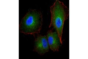 Immunofluorescent analysis of 4 % paraformaldehyde-fixed, 0. (F13A1 抗体  (AA 170-204))