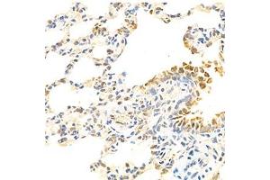 Immunohistochemistry analysis of paraffin-embedded rat lung using Eif2ak1 (ABIN7073875) at dilution of 1: 1000