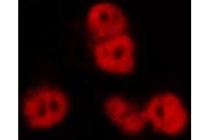 ABIN6269188 staining HeLa by IF/ICC.