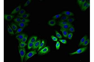 Immunofluorescent analysis of HepG2 cells using ABIN7158219 at dilution of 1:100 and Alexa Fluor 488-congugated AffiniPure Goat Anti-Rabbit IgG(H+L) (LSMEM2 抗体  (AA 1-96))