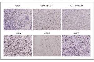 WRN antibody (mAb) tested by Immunohistochemistry. (RECQL2 抗体)